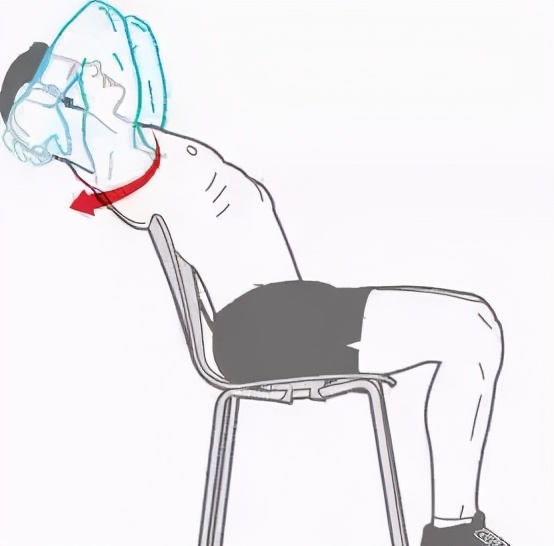 自我改善脊柱弯曲,自我改善脊柱侧弯