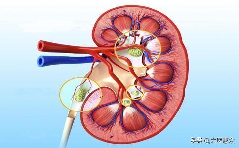 尿黄尿味大难闻是什么原因,太监身上有尿骚原因