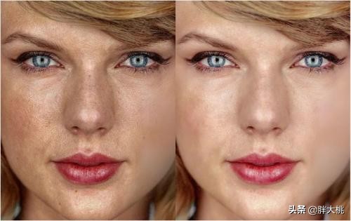 皮肤问题特别复杂怎么改善,皮肤敏感脸皮薄怎么办