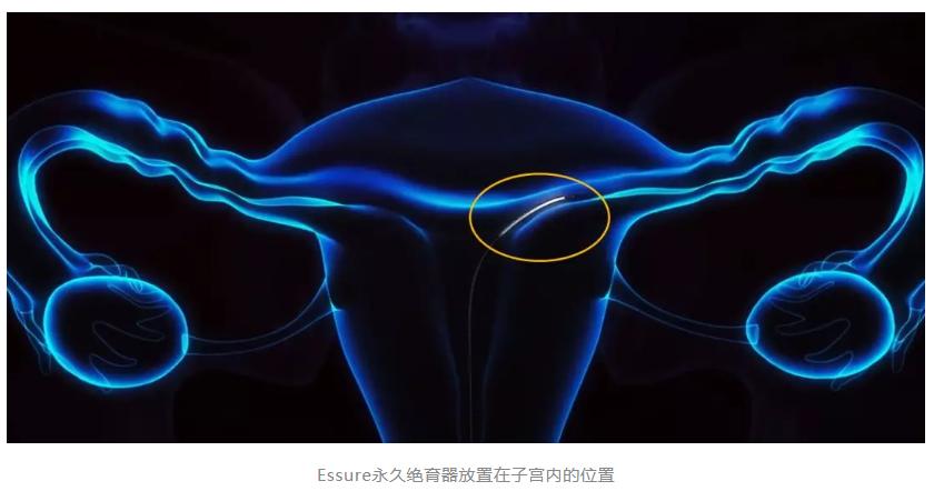 无人捅破的医疗*局骗**,被Netflix8.9分的纪录片曝光了!