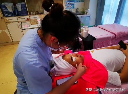 去黑头的方法快速有效,去除黑头以后皮肤该如何护理