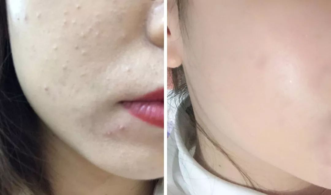 李小冉用什么护肤品好看,李小冉推荐的所有护肤品