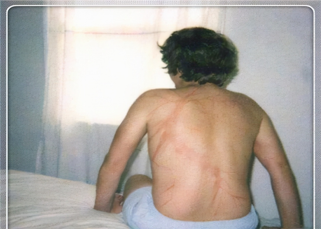 人被雷劈中会发生什么,人被雷劈过后会怎么样