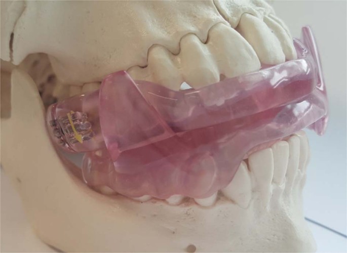 睡觉打呼噜憋住了,打呼噜把自己憋醒对身体有伤害吗