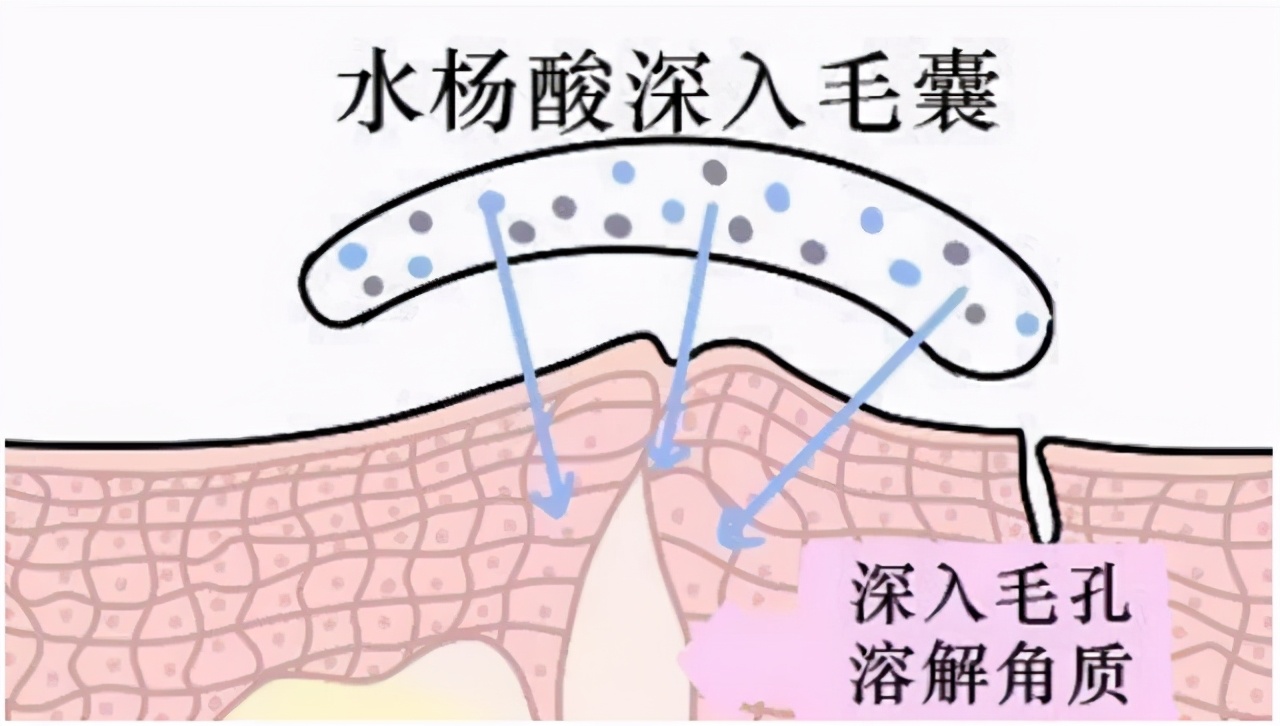 油皮控油的最好方法,混油皮夏季控油保湿