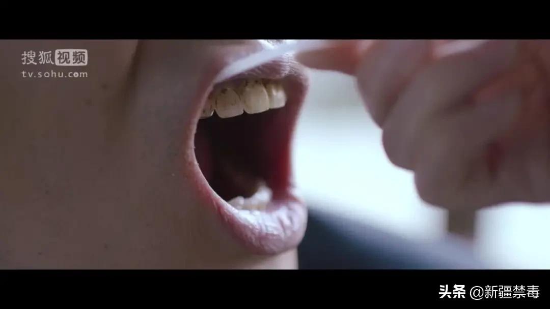 “我的笑容就像一个空洞!”22岁女子吸毒6年,瘦到脸凹牙拔光…