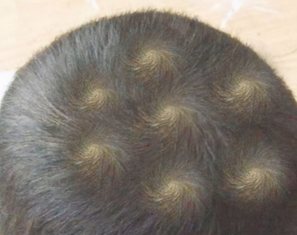 孩子的头旋长偏了是怎么回事,孩子的头旋是歪的