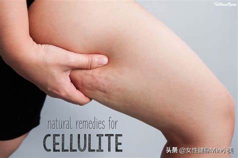 腿上的橘皮组织怎样锻炼,大腿后侧橘皮组织怎么消除