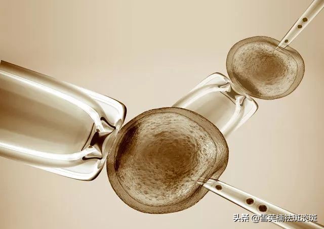 手背老年斑祛斑最有效方法,如何除去老年斑祛斑最有效方法