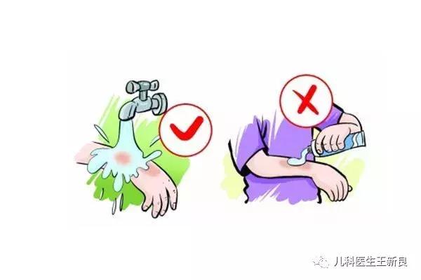 宝宝烫伤水泡要不要弄破,糖尿病烫伤水泡能弄破吗