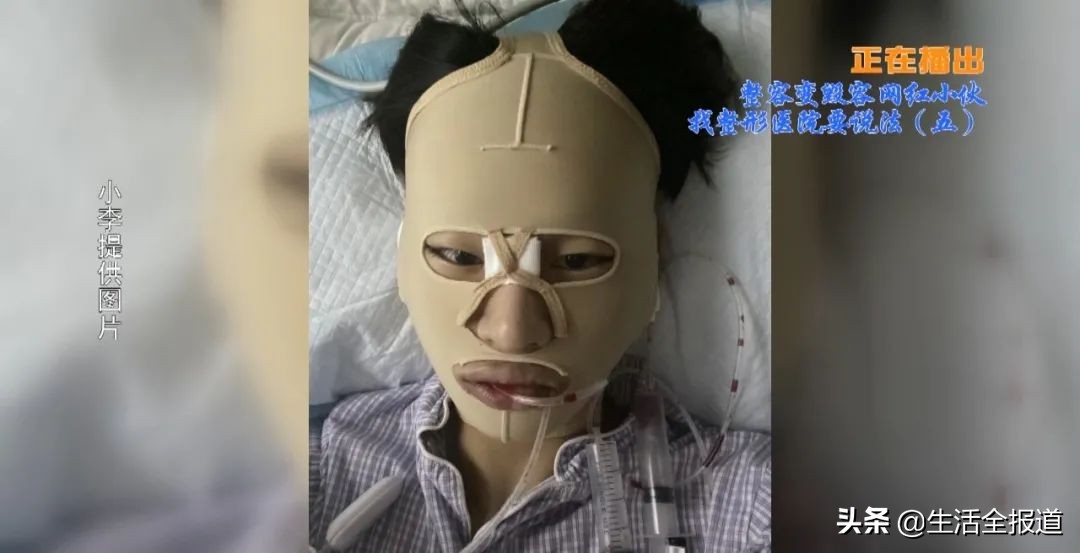 整容医院到底有多少套路？网红帅小伙在武汉一家医美整容“出事了”