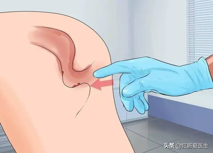 医院里让人尴尬的几项检查,医院里哪些让人尴尬的检查