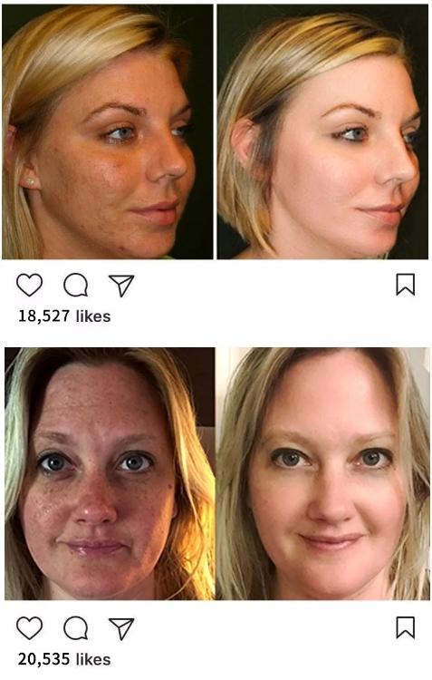 赵露思推荐好物清洁面部,赵露思推荐脸部小熨斗