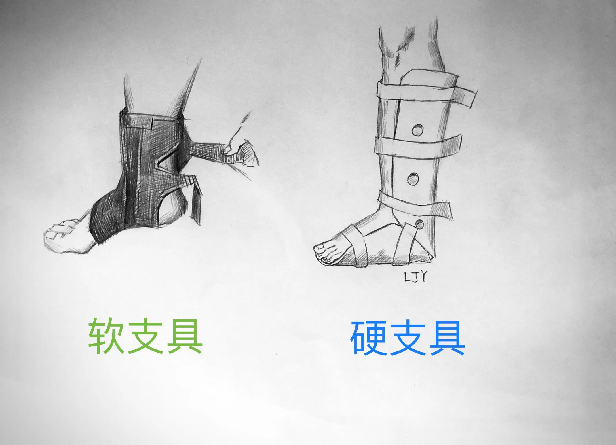 踝关节扭伤后有何表现,踝关节扭伤的自我判断与治疗
