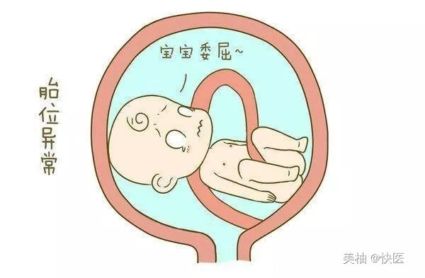 胎儿浅入盆5天会生吗,胎儿入盆的4个预兆