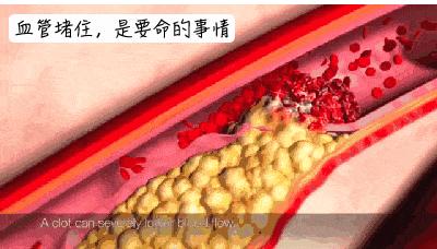 足球球员心脏骤停抢救成功案例,足球赛老人心脏骤停