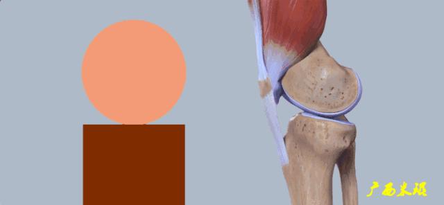 有关半月板的疾病与治疗,听骨科医生讲的话