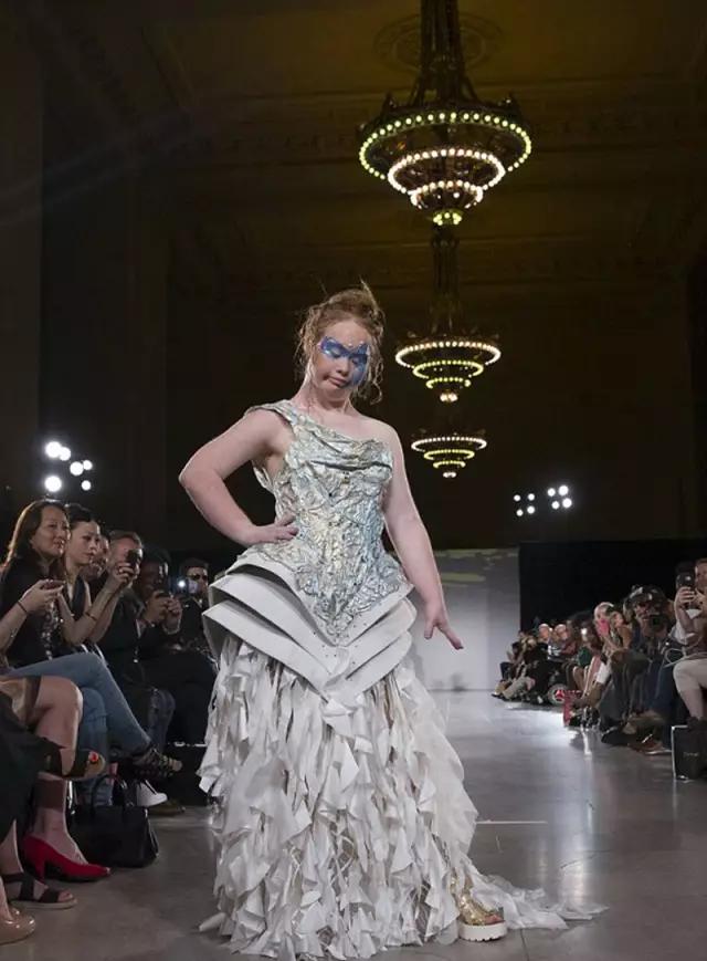 唐氏综合征中国美女,患有唐氏综合征的维密模特