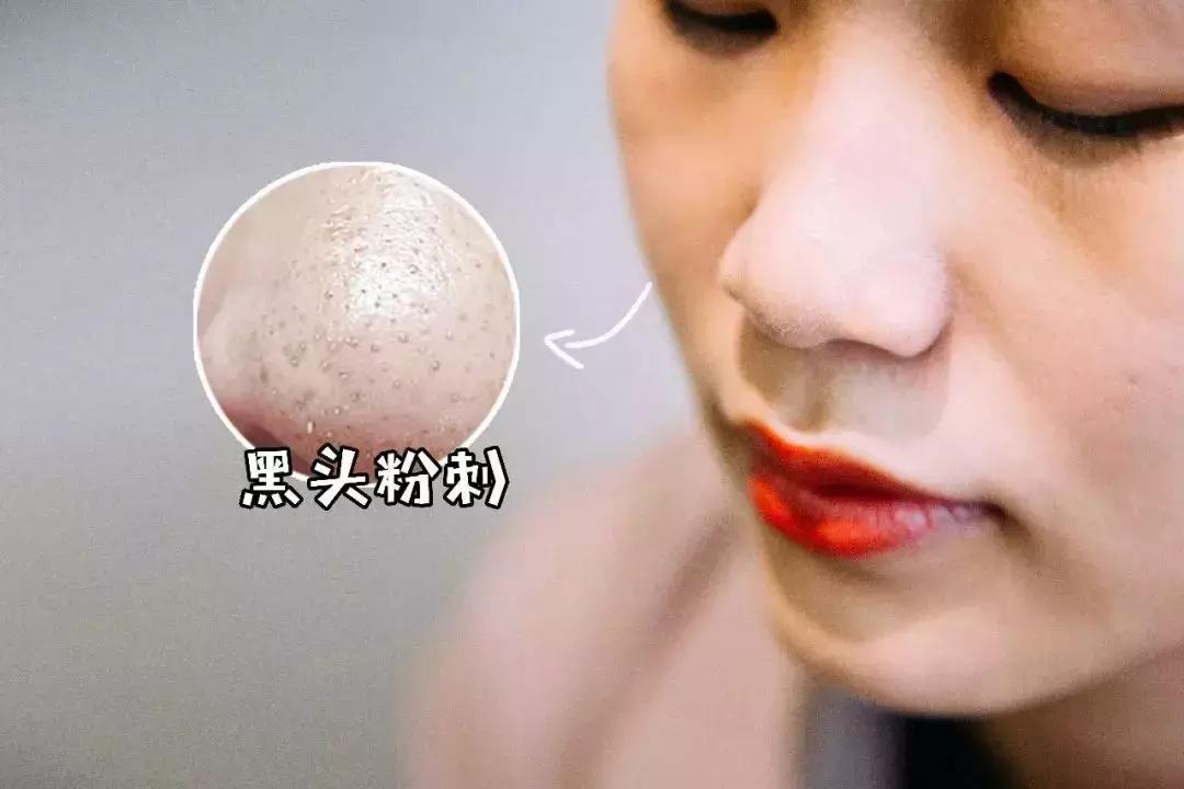 屈臣氏千万别下架的产品,屈臣氏红黑名单