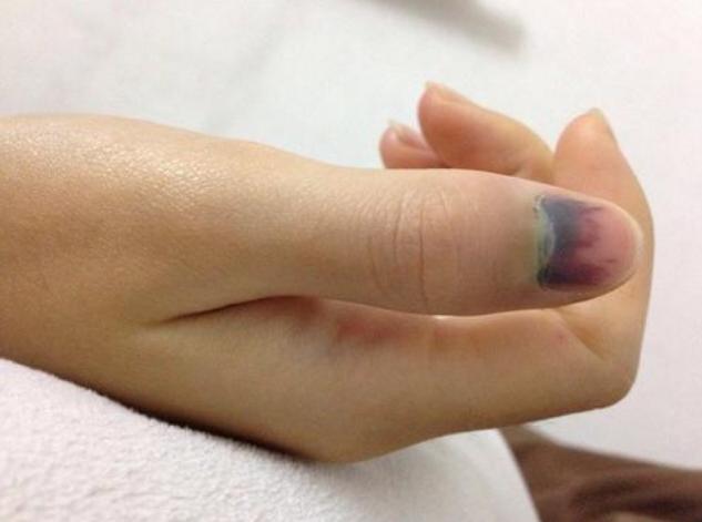 防止小孩被门夹手神器,防小孩门夹手神器