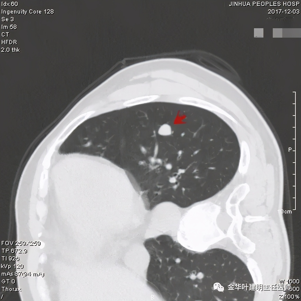 误诊报告图片,误诊案例及案例分析