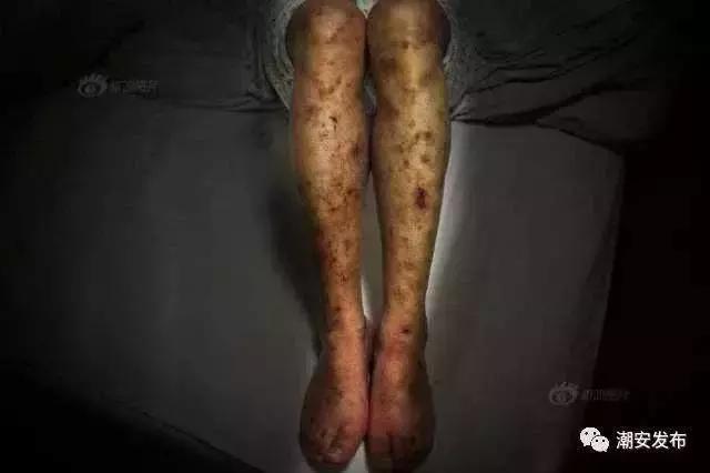 毒品祸害无穷吸毒的危害包括哪些,禁毒的危害知识摘抄