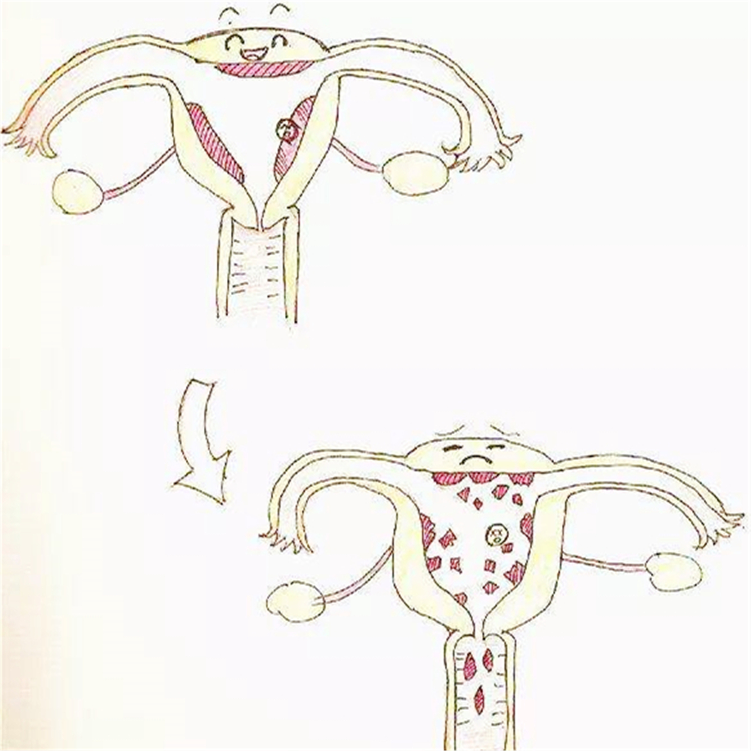 为啥流产了验孕棒测还是两条杠,为什么验孕棒测出第二根杠很淡