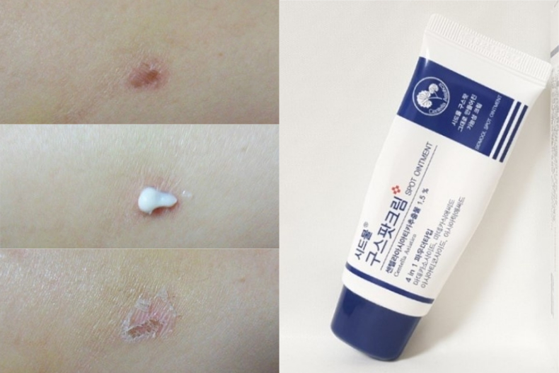 真的很可以买！韩妞最爱用「去疤乳膏TOP3」讨厌的痘印全都掰