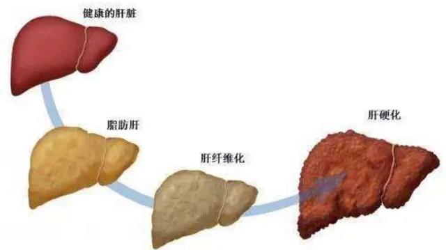健身才不会颓废,健康健身的常识你必须知道