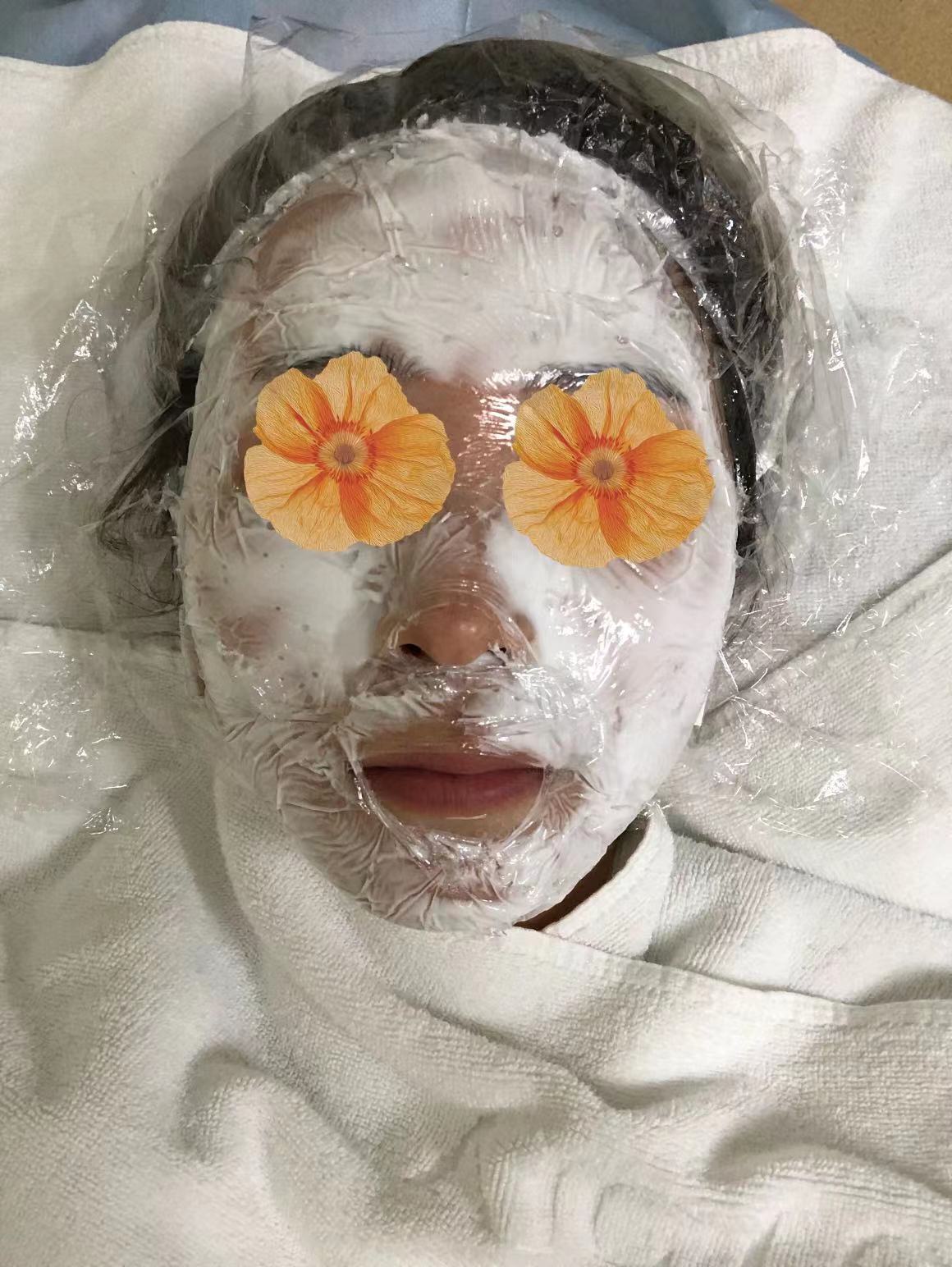 我的医美笔记-水光针