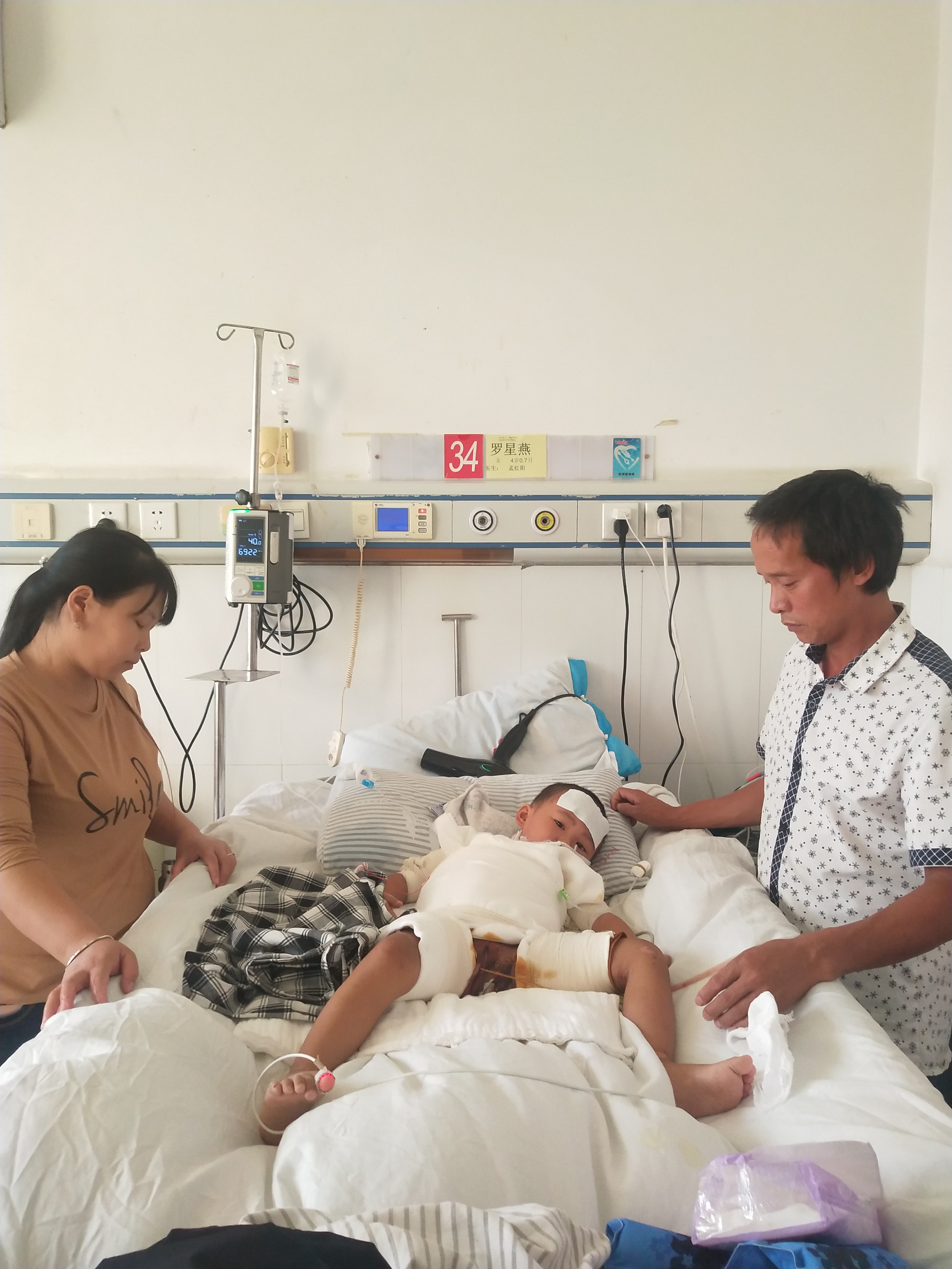 小孩被烫伤妈妈求助好心人,4岁女童重度烫伤父母含泪求助