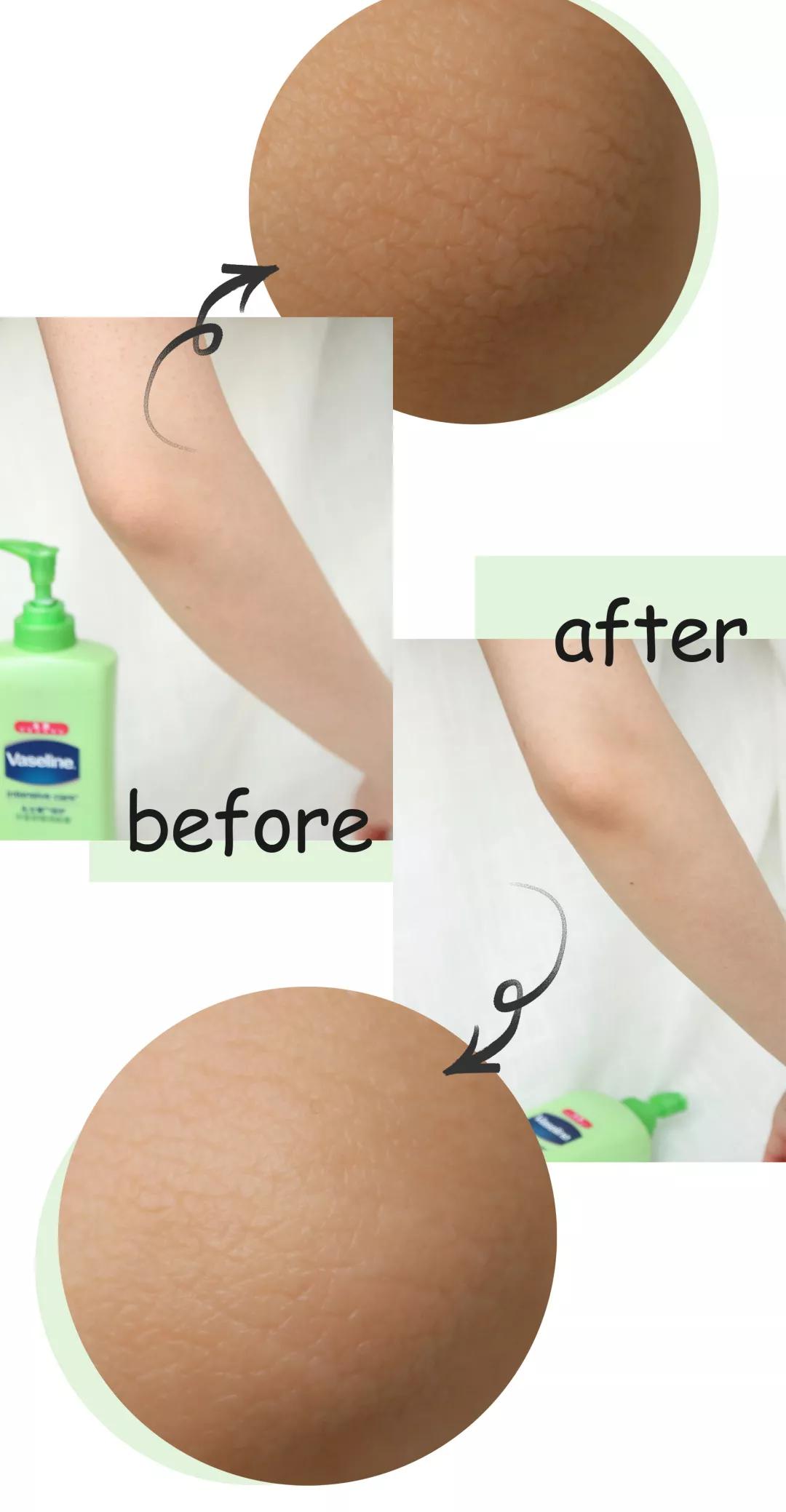 安抚肌肤情绪,安抚紧绷皮肤