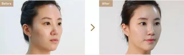 就因为这四个部位,别人像15而你像45