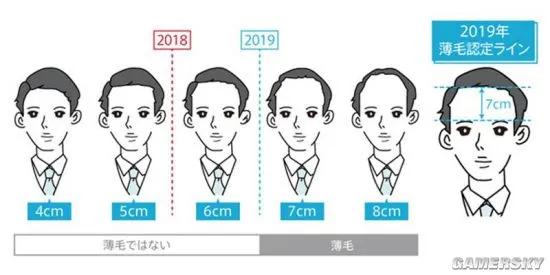 所以秃头的标准是发际线高≥7cm?头秃代表不再是中老年独扛大旗,90后、00后也在积极踊跃加入组织