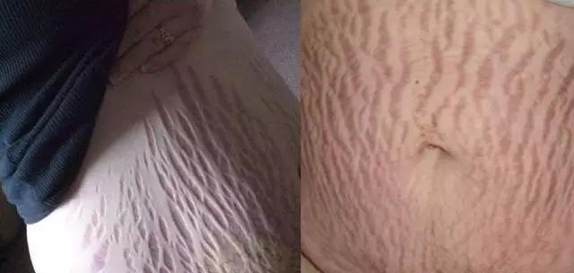 有必要去医院做产后修复吗？看完这些再做决定