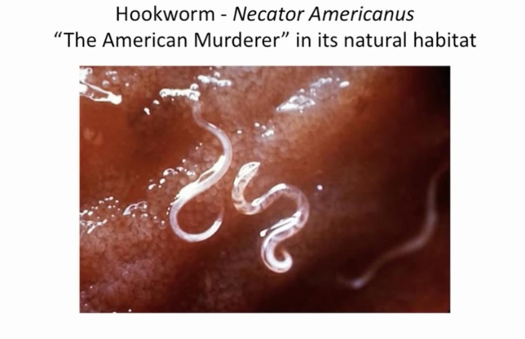 他们生吞3500寄生虫卵,花费1.5万元,只为治疗秃头