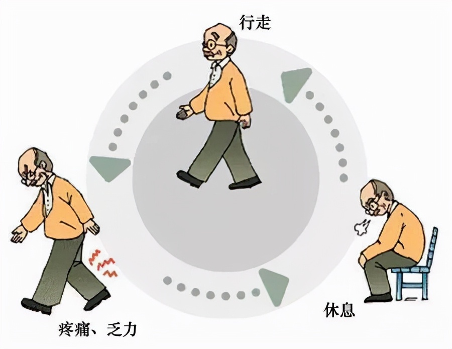 脚背上有个血管通畅的“监测点”