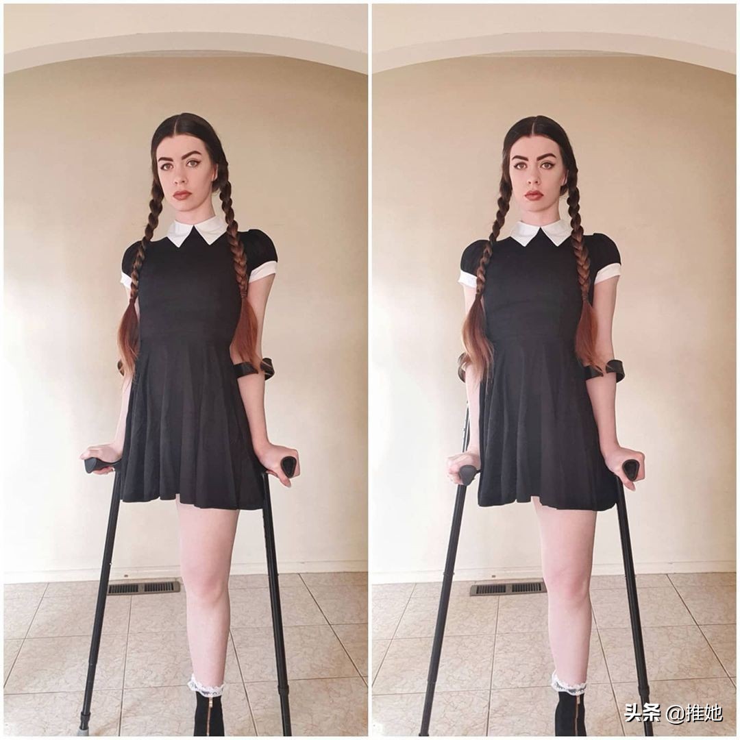 6岁被截肢，20岁被网暴，女孩儿鼓足勇气成为内衣模特