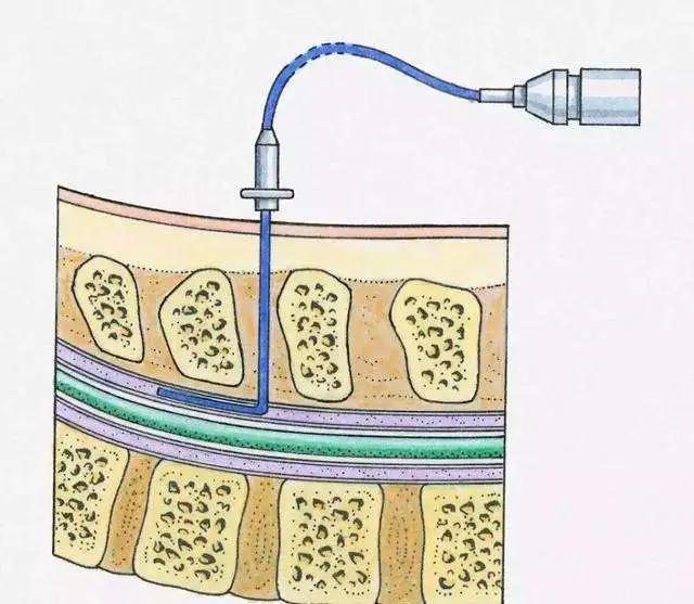 送刚分娩宝妈礼物,送剖腹产妈妈的礼物
