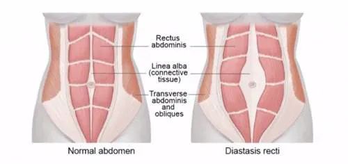 「爱禧课堂」生完孩子肚子还跟怀孕一样，原来是这样！
