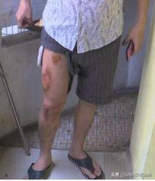 苹果6会自燃吗,iphone6发热严重会不会爆炸