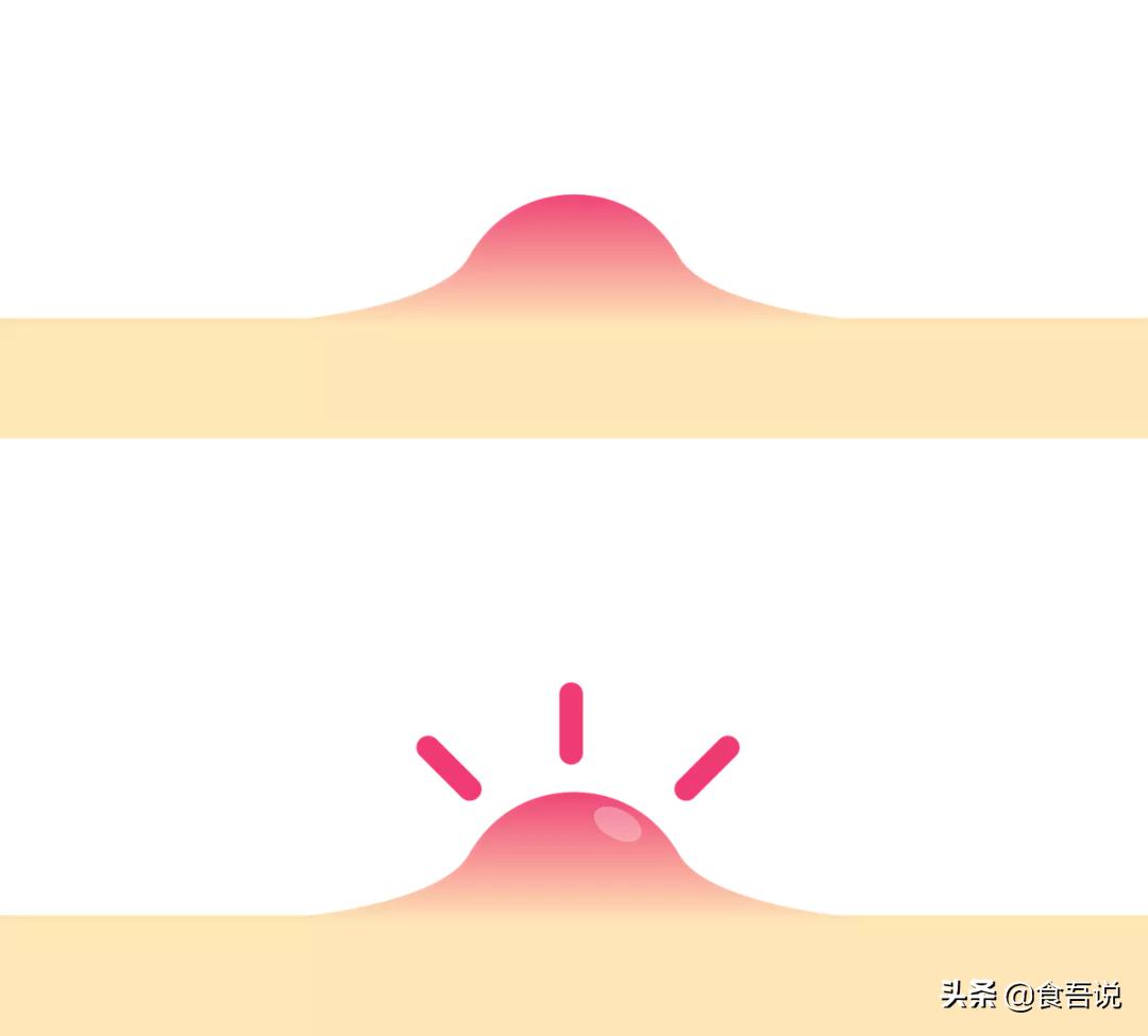 长痘可以吃辣吗,吃辣爆痘怎么办