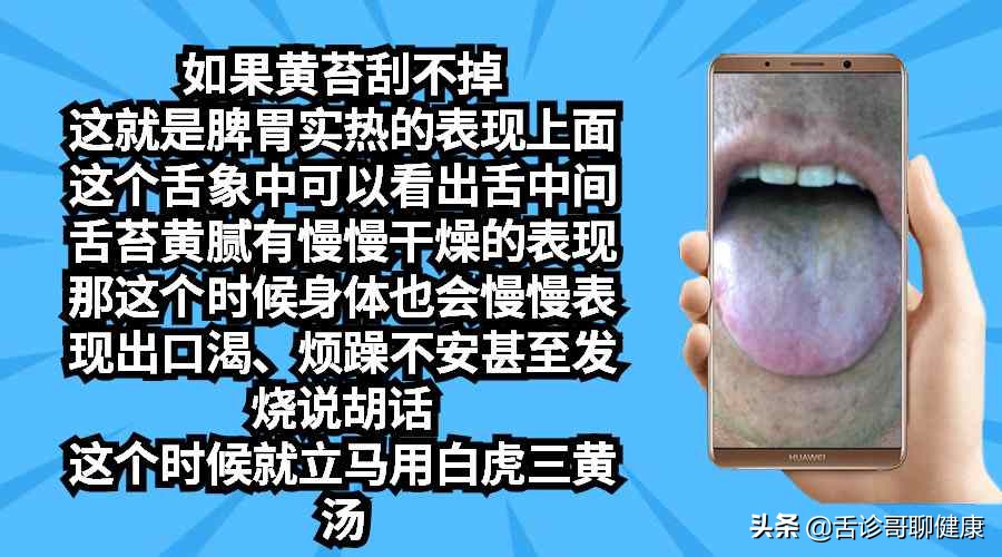 舌诊哥:遗精滑精、气短、虚汗、紧张、焦虑等舌象分析