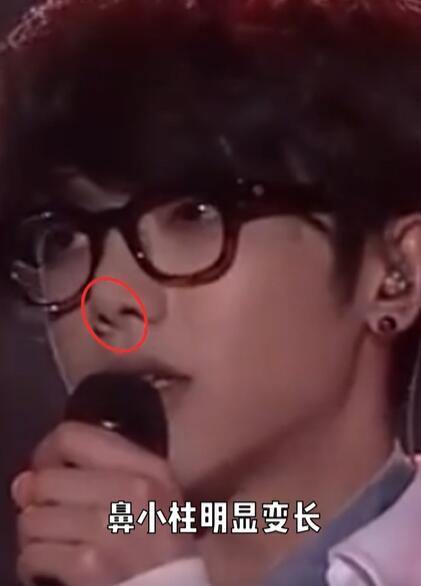 美妆网红晒华晨宇变脸过程质疑其做了3项整容手术，真的不怕被告