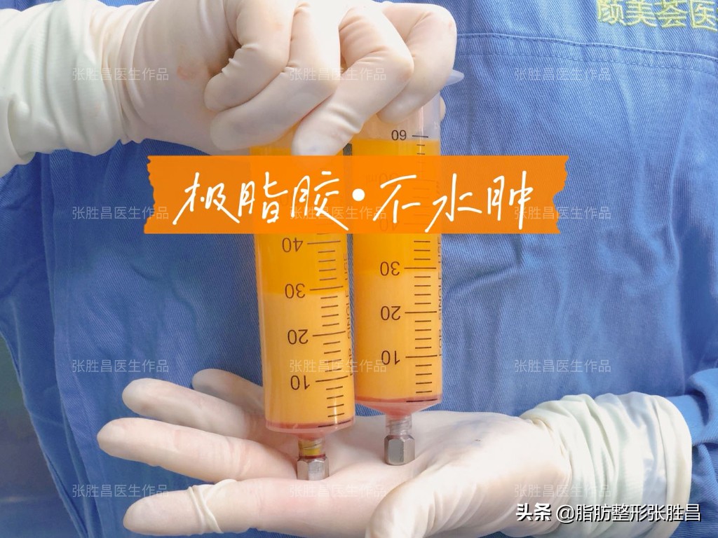 笑久了有法令纹,笑一笑减少法令纹