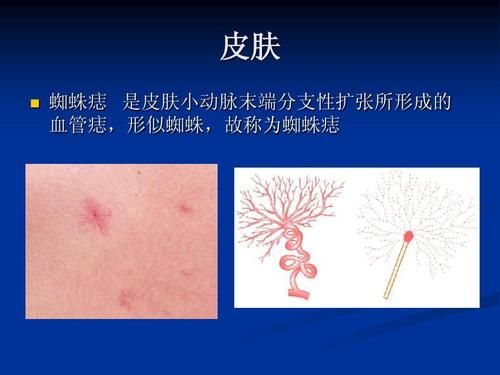 肝毒堆积在身体怎么调理,肝毒长期堆积会咋样