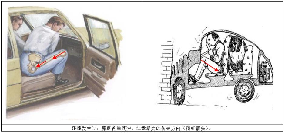 pipkin骨折,pipkin的视频