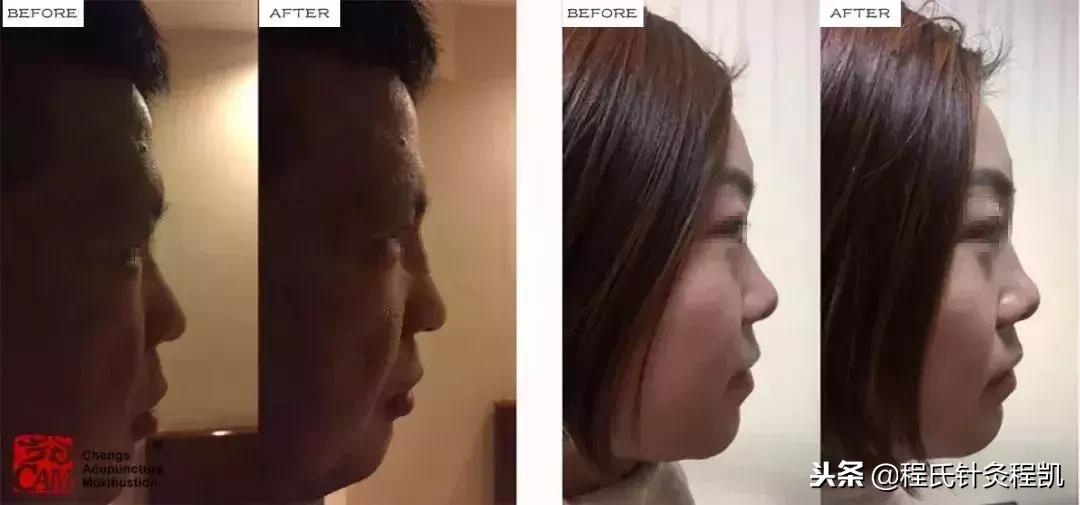 5个永不过时的美容妙招推荐,你需要尝试的10个惊人的美容技巧