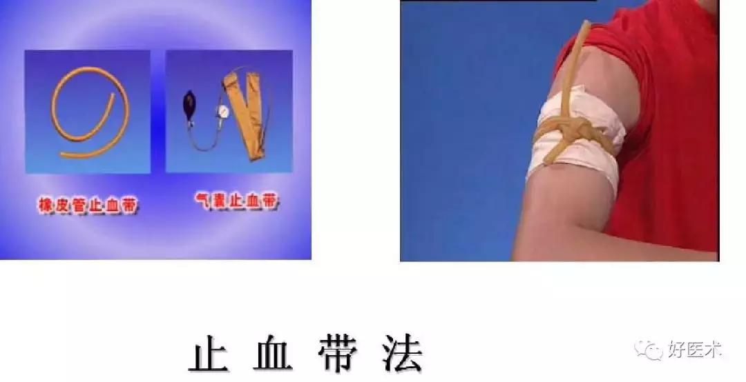 骨科急救处理流程图,骨科急救原则及注意事项