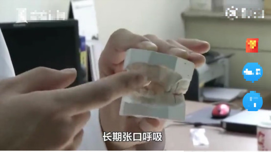 5岁男童张嘴睡觉用嘴呼吸正常吗,小孩反复张嘴闭嘴